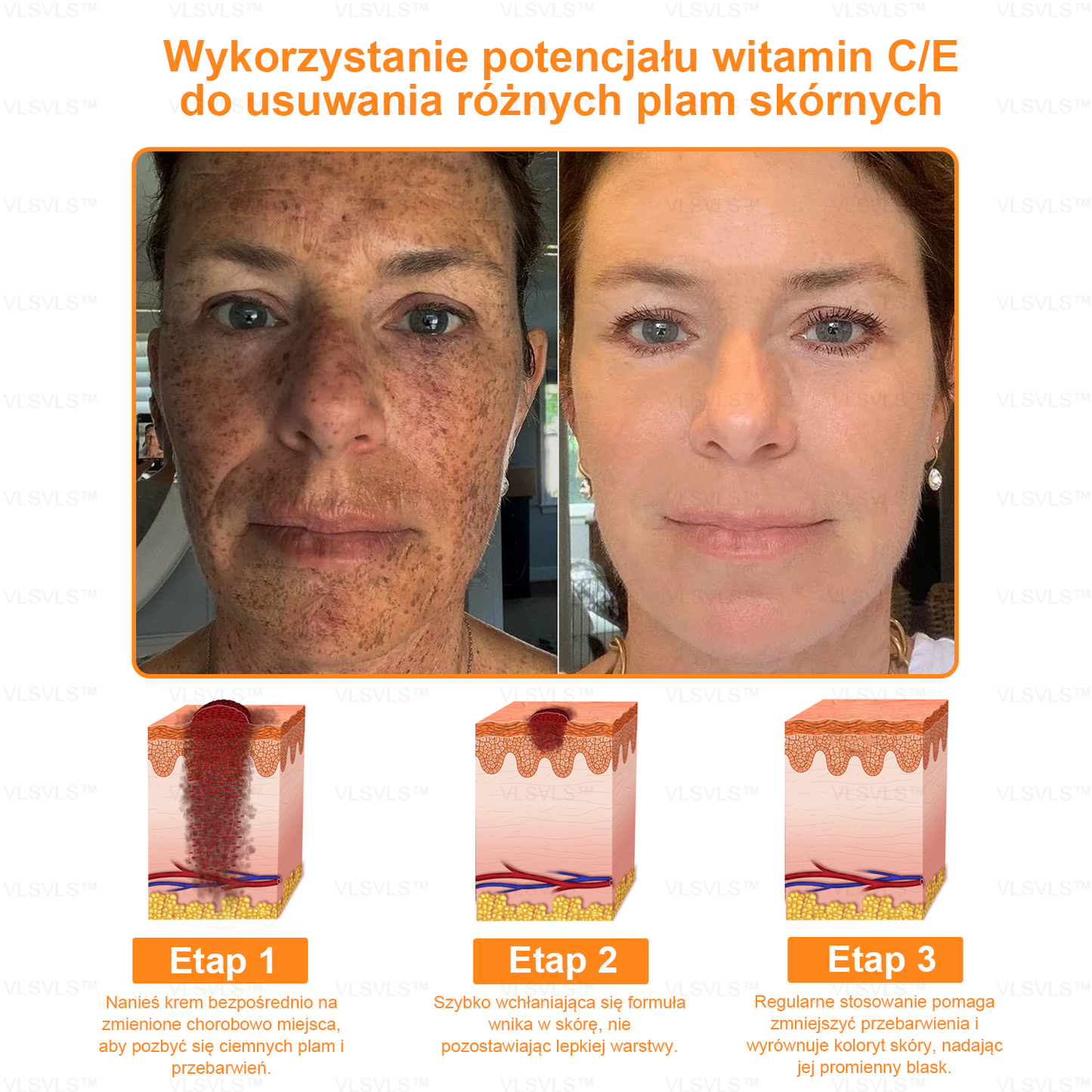 VLSVLS™ KREM NAPRAWCZY Z WENINĄ PSZCZELĄ (🧑⚕️Zalecany przez AAD) - Jad pszczeli oczyszcza skórę, walczy z trądzikiem, wyrównuje koloryt skóry, redukuje blizny, uszkodzenia słoneczne i plamy starcze