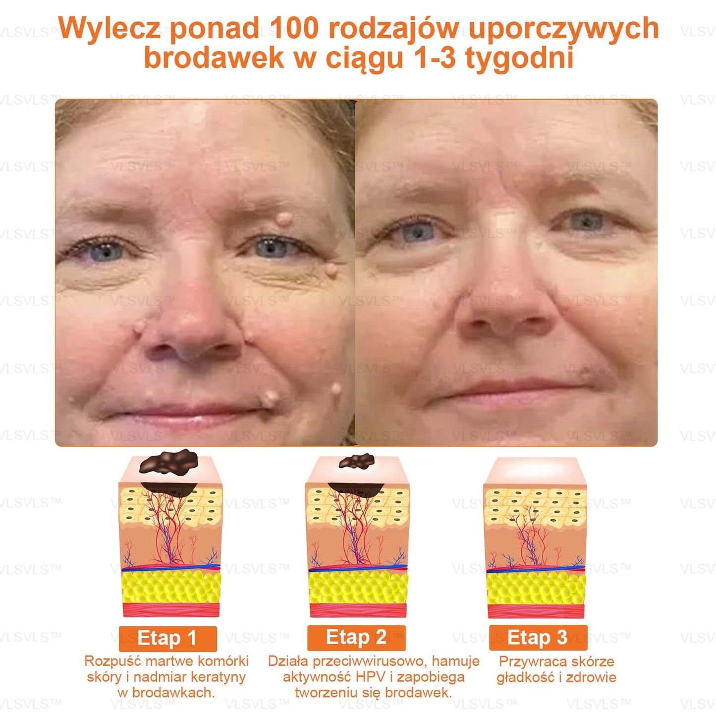 VLSVLS™ KREM NAPRAWCZY Z WENINĄ PSZCZELĄ (🧑⚕️Zalecany przez AAD) - Jad pszczeli oczyszcza skórę, walczy z trądzikiem, wyrównuje koloryt skóry, redukuje blizny, uszkodzenia słoneczne i plamy starcze