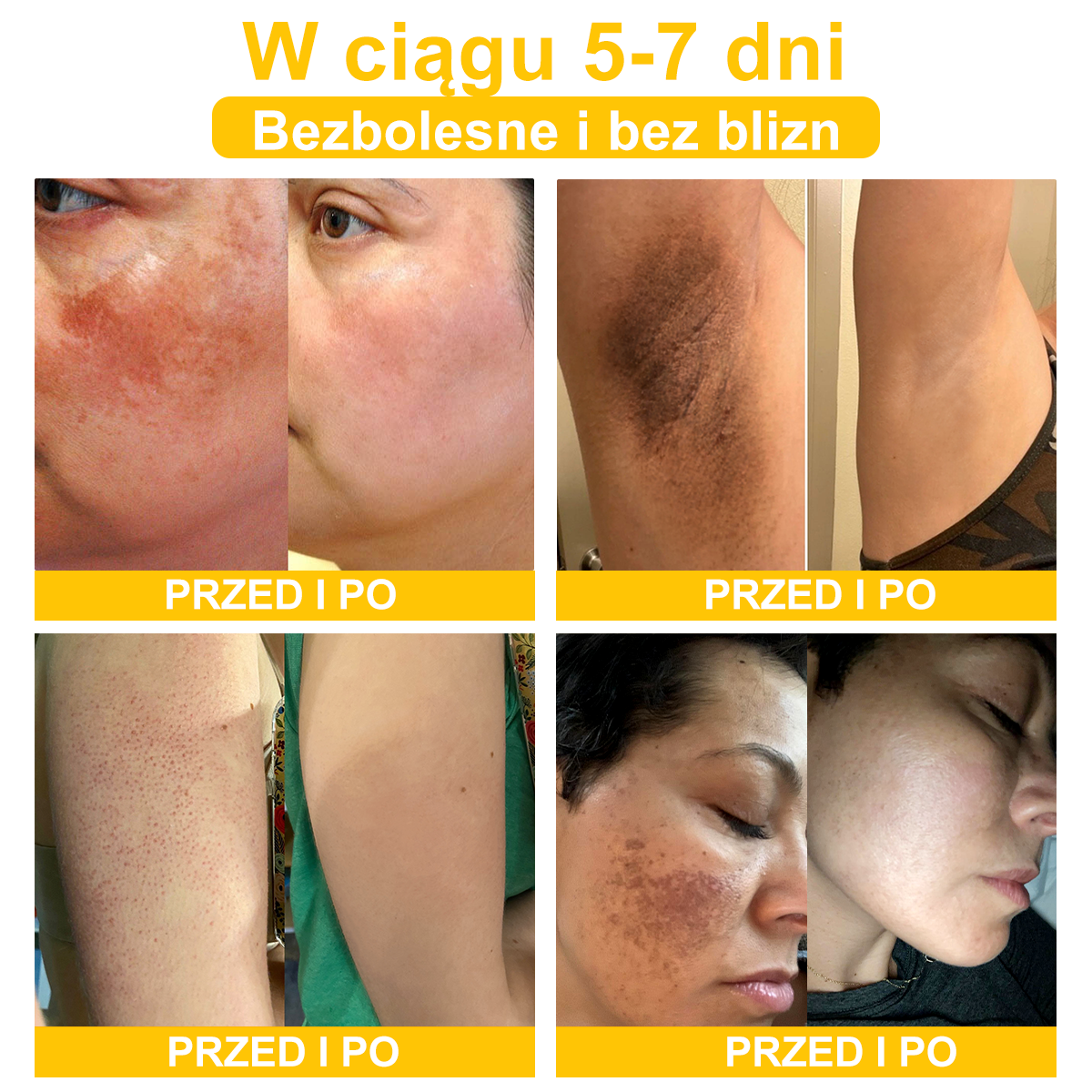 𝑽𝒆𝒍𝒊𝒔𝒔𝒆™ 𝑲𝒓𝒆𝒎 𝒛 𝑱𝒂𝒅ó𝒘 𝑷𝒔𝒛𝒄𝒛𝒆𝒍𝒊𝒄𝒉, 𝒏𝒂 𝑼𝒔𝒖𝒘𝒂𝒏𝒊𝒆 𝑩𝒓𝒐𝒅𝒂𝒘𝒆𝒌, 𝑻𝒓ą𝒅𝒛𝒊𝒌𝒖 𝒊 𝑩𝒍𝒊𝒛𝒏 - 𝑳𝒆𝒄𝒛𝒚 𝑾𝒊𝒆𝒍𝒆 𝑷𝒓𝒐𝒃𝒍𝒆𝒎ó𝒘 𝑺𝒌ó𝒓𝒏𝒚𝒄𝒉 (🧑⚕️𝒁𝒂𝒍𝒆𝒄𝒂𝒏𝒆 𝒑𝒓𝒛𝒆𝒛 𝑨𝑨𝑫)