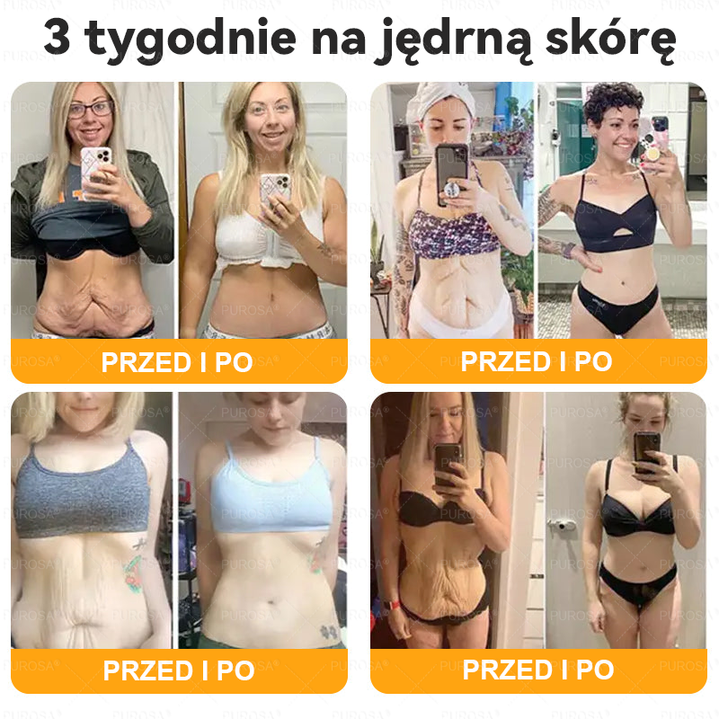 Wyprodukowany i wysłany z Polski 🌸PUROSA® Krem z jadem pszczelim do regeneracji skóry🔥🔥 OSTATNI DZIEŃ – 80% ZNIŻKI!