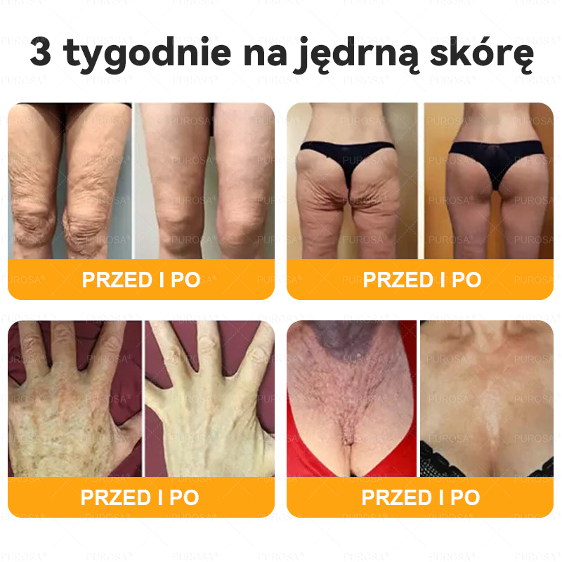 Wyprodukowany i wysłany z Polski 🌸PUROSA® Krem z jadem pszczelim do regeneracji skóry🔥🔥 OSTATNI DZIEŃ – 80% ZNIŻKI!