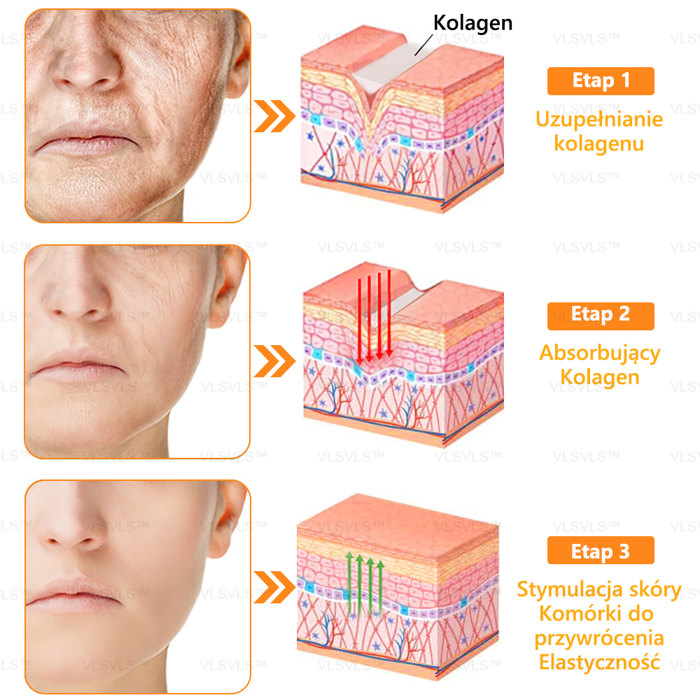 VLSVLS™ KREM NAPRAWCZY Z WENINĄ PSZCZELĄ (🧑⚕️Zalecany przez AAD) - Jad pszczeli oczyszcza skórę, walczy z trądzikiem, wyrównuje koloryt skóry, redukuje blizny, uszkodzenia słoneczne i plamy starcze