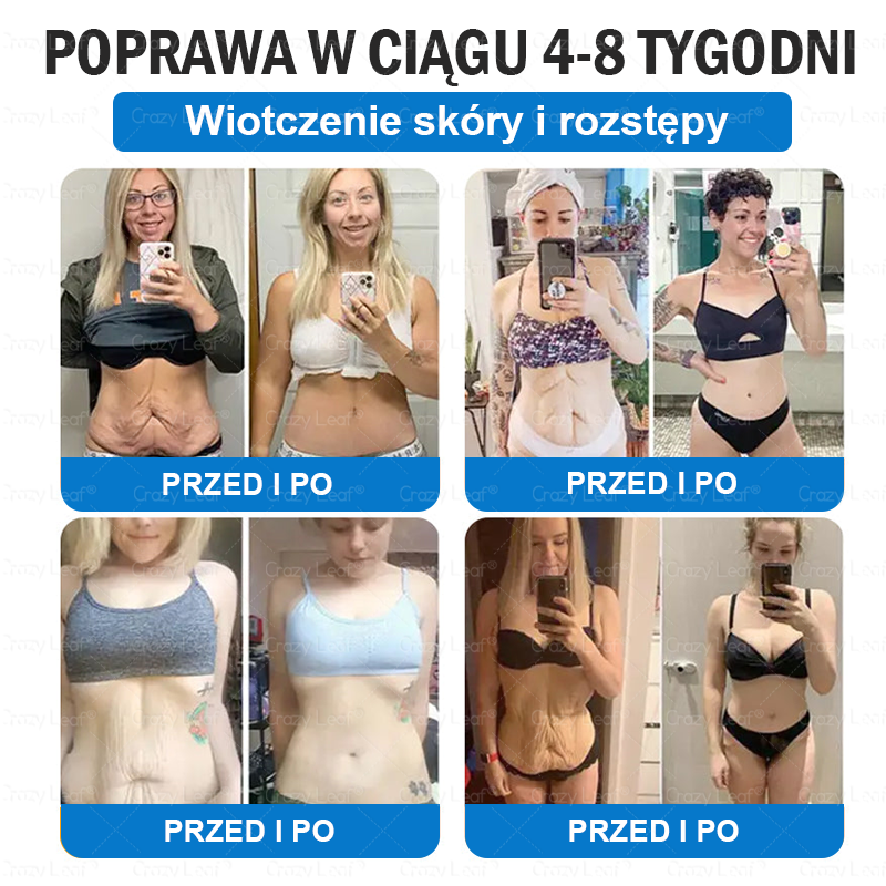Klinicznie potwierdzone|Oficjalny sklep|𝐶𝑟𝑎𝑧𝑦𝐿𝑒𝑎𝑓® SMGT- GLP-1 Nano Microneedle Slim& Firm Patch|Działa na otyłość, wiotką skórę, nadciśnienie, cukrzycę, stłuszczenie wątroby, bóle stawów, bóle ciała i inne dolegliwości