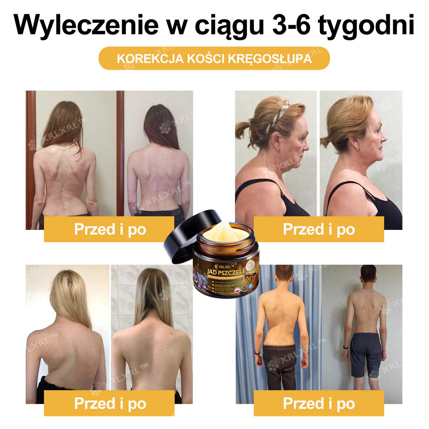 🎁 Zostało już tylko 5 pudełek! Oferujemy Państwu dodatkowe 50% rabatu! Bądź fit i zdrowy. Jeśli przegrasz teraz, kolejną szansę dostaniesz dopiero w przyszłym roku.