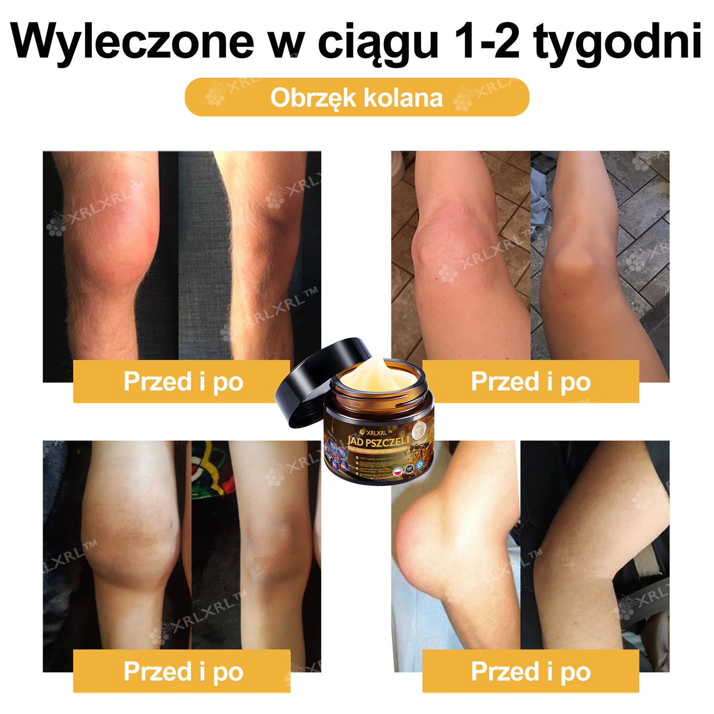 🎁 Zostało już tylko 5 pudełek! Oferujemy Państwu dodatkowe 50% rabatu! Bądź fit i zdrowy. Jeśli przegrasz teraz, kolejną szansę dostaniesz dopiero w przyszłym roku.