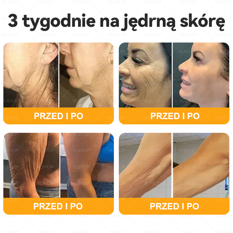 Wyprodukowane i wysłane z Polski🌸VLSVLS®JAD PSZCZELIKrem do regeneracji skóry🔥🔥 OSTATNI DZIEŃ 80% ZNIŻKI