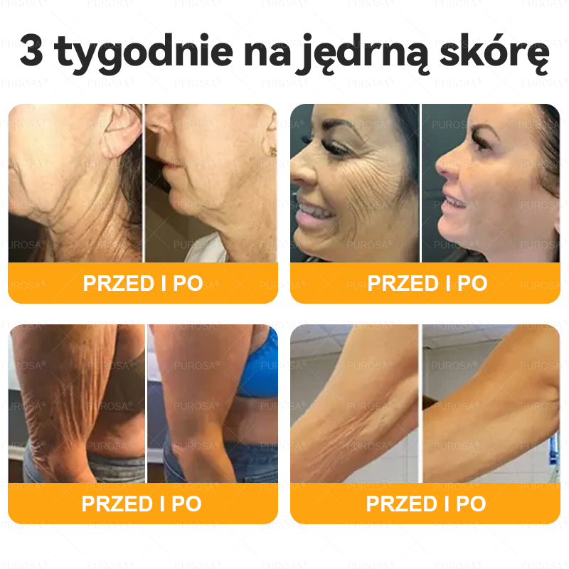 Wyprodukowany i wysłany z Polski 🌸PUROSA® Krem z jadem pszczelim do regeneracji skóry🔥🔥 OSTATNI DZIEŃ – 80% ZNIŻKI!