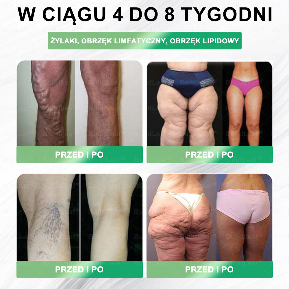 ⏰ Zostało już tylko 5 pudełek! Oferujemy Państwu dodatkowe 50% rabatu! Bądź fit i zdrowy. Jeśli przegrasz teraz, kolejną szansę dostaniesz dopiero w przyszłym roku.