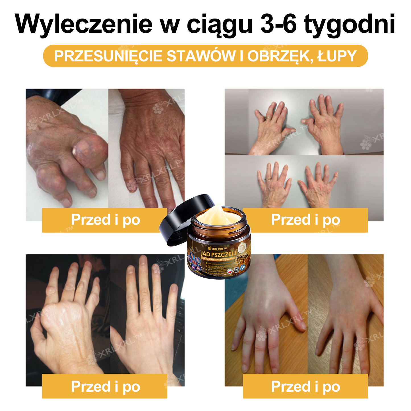 🎁 Zostało już tylko 5 pudełek! Oferujemy Państwu dodatkowe 50% rabatu! Bądź fit i zdrowy. Jeśli przegrasz teraz, kolejną szansę dostaniesz dopiero w przyszłym roku.