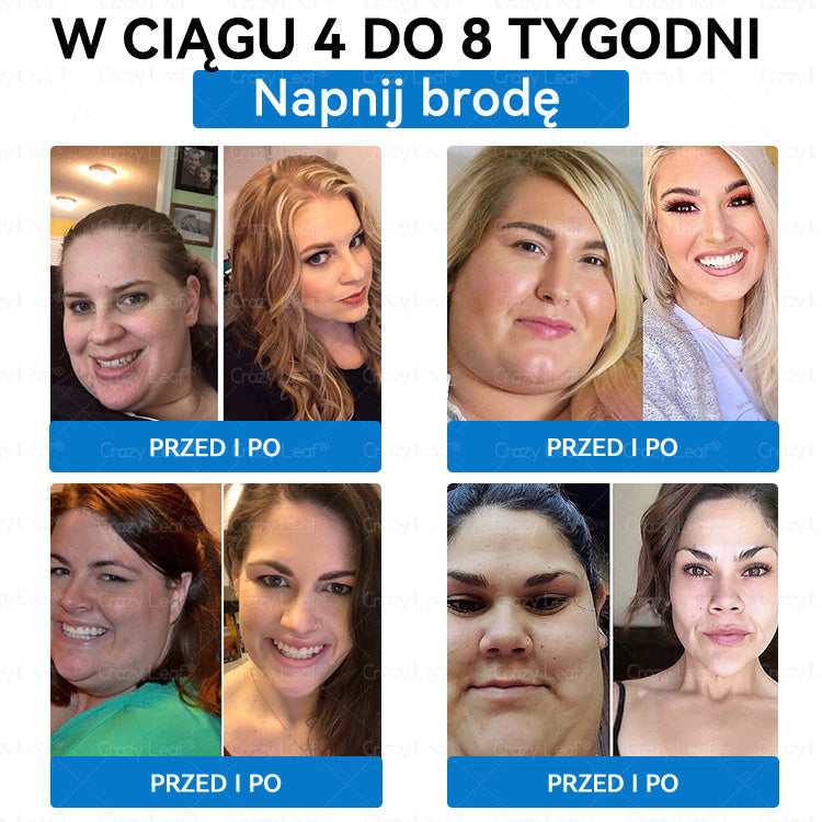 Klinicznie potwierdzone|Oficjalny sklep|𝐶𝑟𝑎𝑧𝑦𝐿𝑒𝑎𝑓® SMGT- GLP-1 Nano Microneedle Slim& Firm Patch|Działa na otyłość, wiotką skórę, nadciśnienie, cukrzycę, stłuszczenie wątroby, bóle stawów, bóle ciała i inne dolegliwości