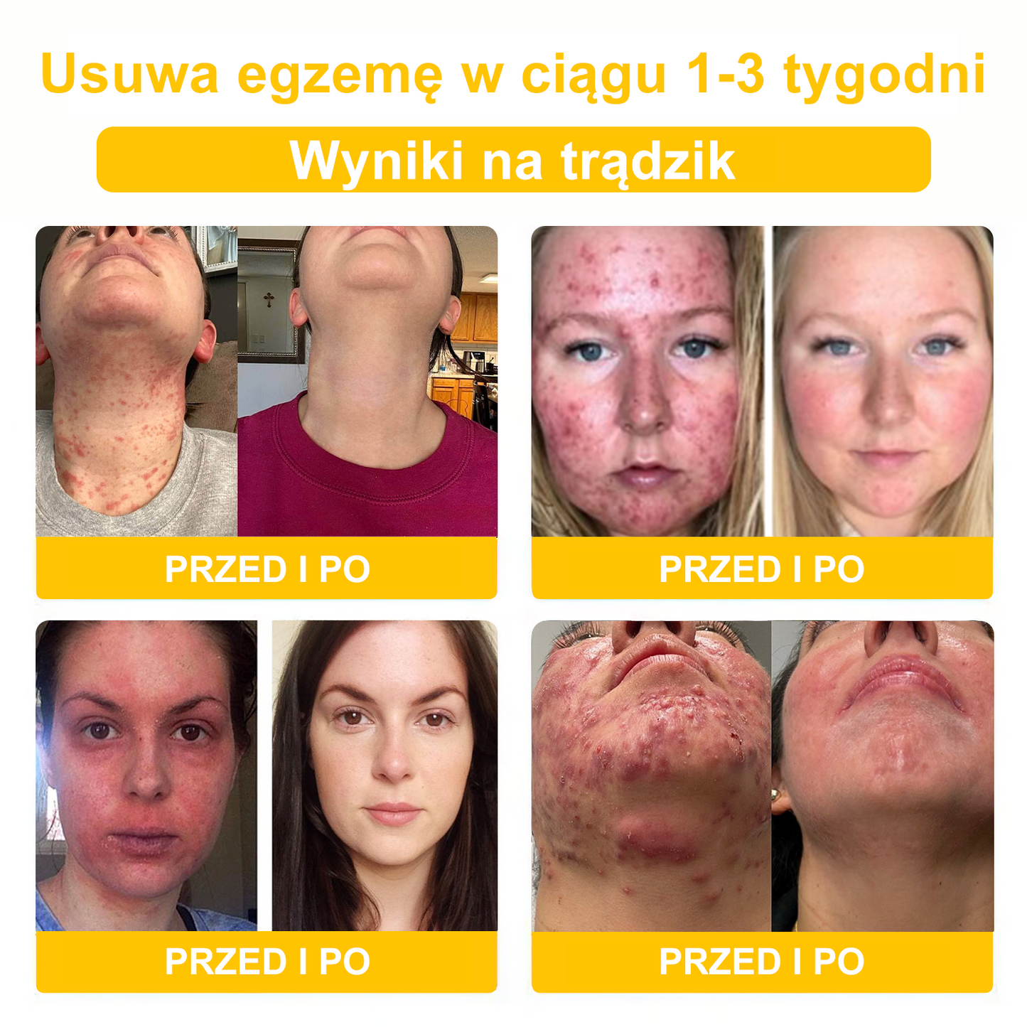𝑽𝒆𝒍𝒊𝒔𝒔𝒆™ 𝑲𝒓𝒆𝒎 𝒛 𝑱𝒂𝒅ó𝒘 𝑷𝒔𝒛𝒄𝒛𝒆𝒍𝒊𝒄𝒉, 𝒏𝒂 𝑼𝒔𝒖𝒘𝒂𝒏𝒊𝒆 𝑩𝒓𝒐𝒅𝒂𝒘𝒆𝒌, 𝑻𝒓ą𝒅𝒛𝒊𝒌𝒖 𝒊 𝑩𝒍𝒊𝒛𝒏 - 𝑳𝒆𝒄𝒛𝒚 𝑾𝒊𝒆𝒍𝒆 𝑷𝒓𝒐𝒃𝒍𝒆𝒎ó𝒘 𝑺𝒌ó𝒓𝒏𝒚𝒄𝒉 (🧑⚕️𝒁𝒂𝒍𝒆𝒄𝒂𝒏𝒆 𝒑𝒓𝒛𝒆𝒛 𝑨𝑨𝑫)