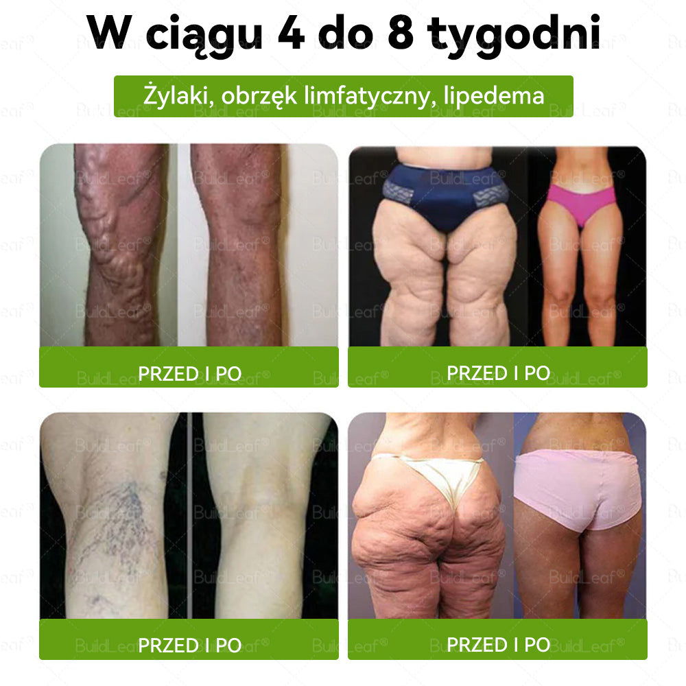 Wyprodukowano i wysłano z Polski 🌿BuildLeaf® Tyrzepatyd GLP-1 Krople odchudzające i wspomagające zdrowie🇵🇱 OSTATNI DZIEŃ – SKORZYSTAJ Z 80% ZNIŻKI!