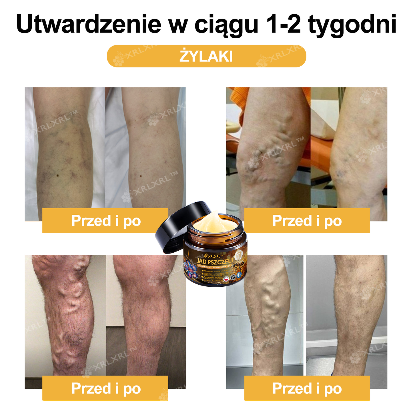 🎁 Zostało już tylko 5 pudełek! Oferujemy Państwu dodatkowe 50% rabatu! Bądź fit i zdrowy. Jeśli przegrasz teraz, kolejną szansę dostaniesz dopiero w przyszłym roku.