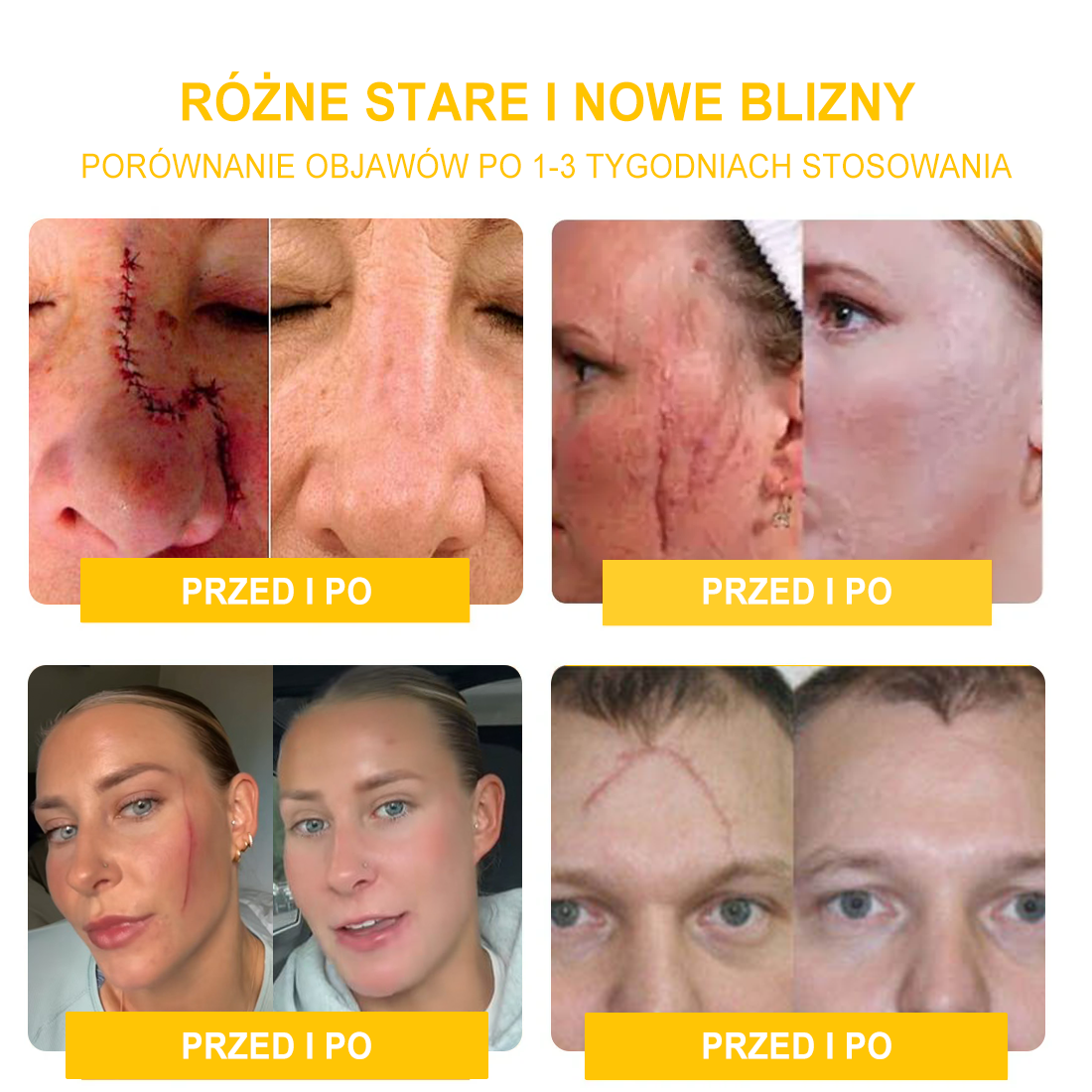 𝑽𝒆𝒍𝒊𝒔𝒔𝒆™ 𝑲𝒓𝒆𝒎 𝒛 𝑱𝒂𝒅ó𝒘 𝑷𝒔𝒛𝒄𝒛𝒆𝒍𝒊𝒄𝒉, 𝒏𝒂 𝑼𝒔𝒖𝒘𝒂𝒏𝒊𝒆 𝑩𝒓𝒐𝒅𝒂𝒘𝒆𝒌, 𝑻𝒓ą𝒅𝒛𝒊𝒌𝒖 𝒊 𝑩𝒍𝒊𝒛𝒏 - 𝑳𝒆𝒄𝒛𝒚 𝑾𝒊𝒆𝒍𝒆 𝑷𝒓𝒐𝒃𝒍𝒆𝒎ó𝒘 𝑺𝒌ó𝒓𝒏𝒚𝒄𝒉 (🧑⚕️𝒁𝒂𝒍𝒆𝒄𝒂𝒏𝒆 𝒑𝒓𝒛𝒆𝒛 𝑨𝑨𝑫)