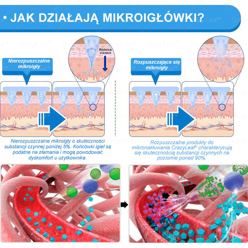 Klinicznie potwierdzone|Oficjalny sklep|𝐶𝑟𝑎𝑧𝑦𝐿𝑒𝑎𝑓® SMGT- GLP-1 Nano Microneedle Slim& Firm Patch|Działa na otyłość, wiotką skórę, nadciśnienie, cukrzycę, stłuszczenie wątroby, bóle stawów, bóle ciała i inne dolegliwości