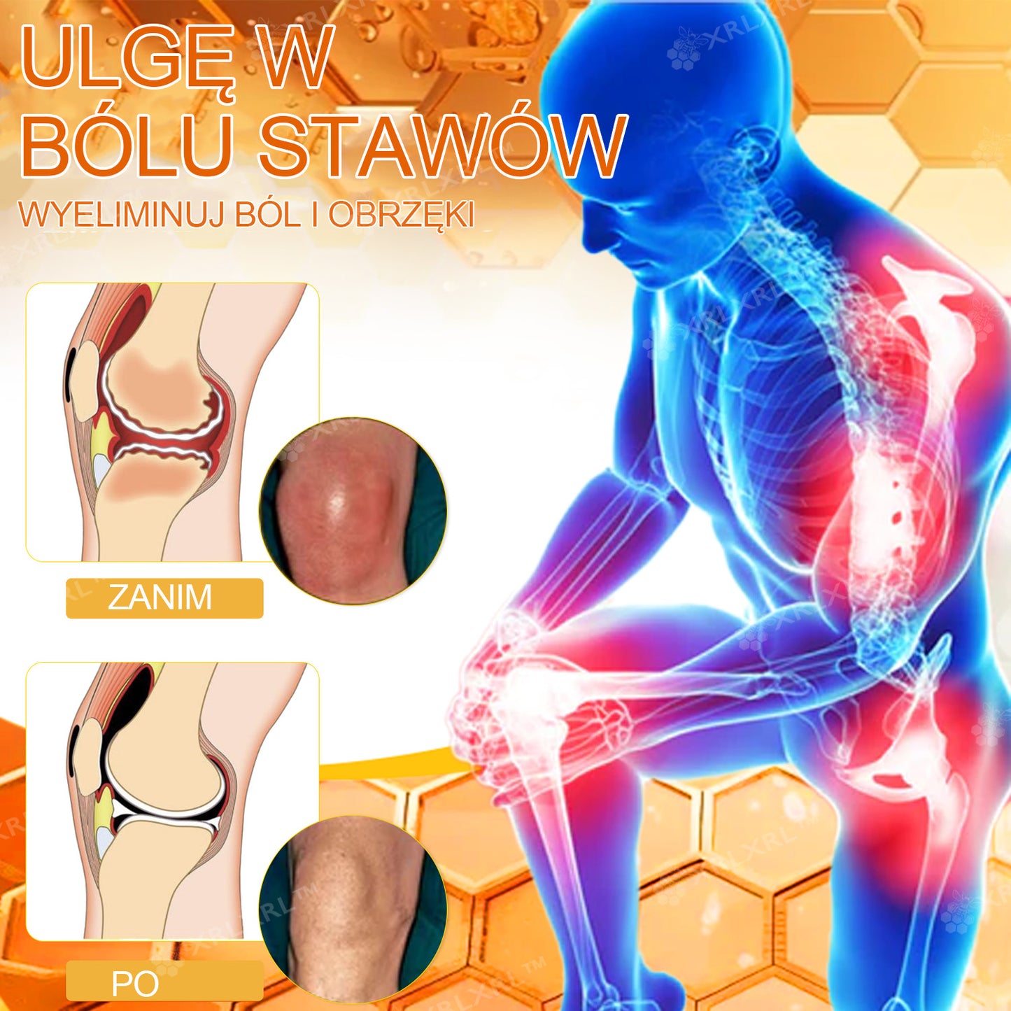 🎁 Zostało już tylko 5 pudełek! Oferujemy Państwu dodatkowe 50% rabatu! Bądź fit i zdrowy. Jeśli przegrasz teraz, kolejną szansę dostaniesz dopiero w przyszłym roku.