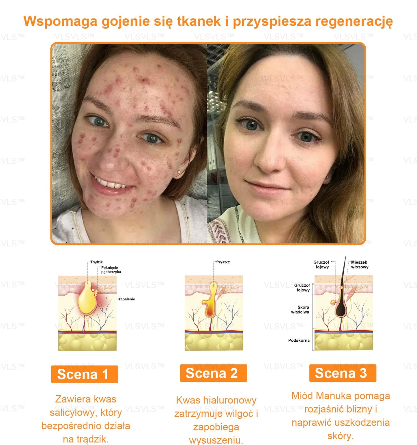 VLSVLS™ KREM NAPRAWCZY Z WENINĄ PSZCZELĄ (🧑⚕️Zalecany przez AAD) - Jad pszczeli oczyszcza skórę, walczy z trądzikiem, wyrównuje koloryt skóry, redukuje blizny, uszkodzenia słoneczne i plamy starcze