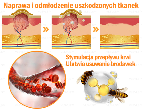 VLSVLS™ KREM NAPRAWCZY Z WENINĄ PSZCZELĄ (🧑‍⚕️Zalecany przez AAD) - Jad pszczeli oczyszcza skórę, walczy z trądzikiem, wyrównuje koloryt skóry, redukuje blizny, uszkodzenia słoneczne i plamy starcze