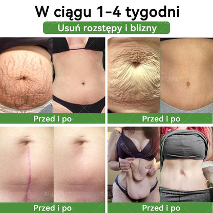 波兰XRLXRL™ Potężna HerbIon Negatywna Jonowa Detox Plaster Odchudzający - Rekomendowane przez ASMBS