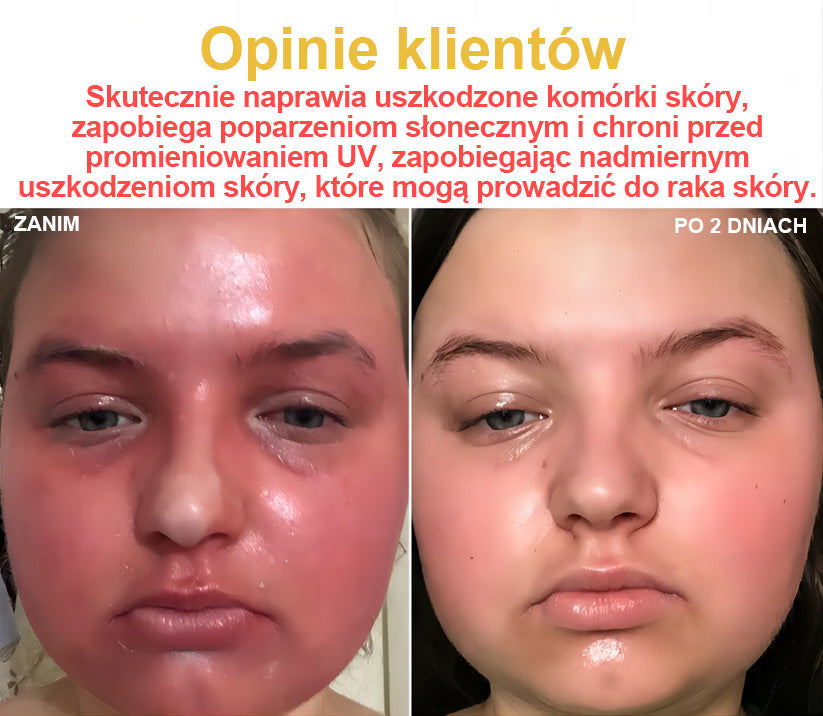 🎁 Zostało już tylko 5 pudełek! Oferujemy Państwu dodatkowe 50% rabatu! Bądź fit i zdrowy. Jeśli przegrasz teraz, kolejną szansę dostaniesz dopiero w przyszłym roku.