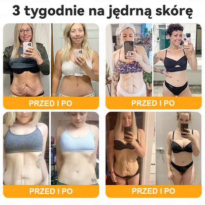 Wyprodukowany i wysłany z Polski 🌸PUROSA® Krem z jadem pszczelim do regeneracji skóry🔥🔥 OSTATNI DZIEŃ – 80% ZNIŻKI!