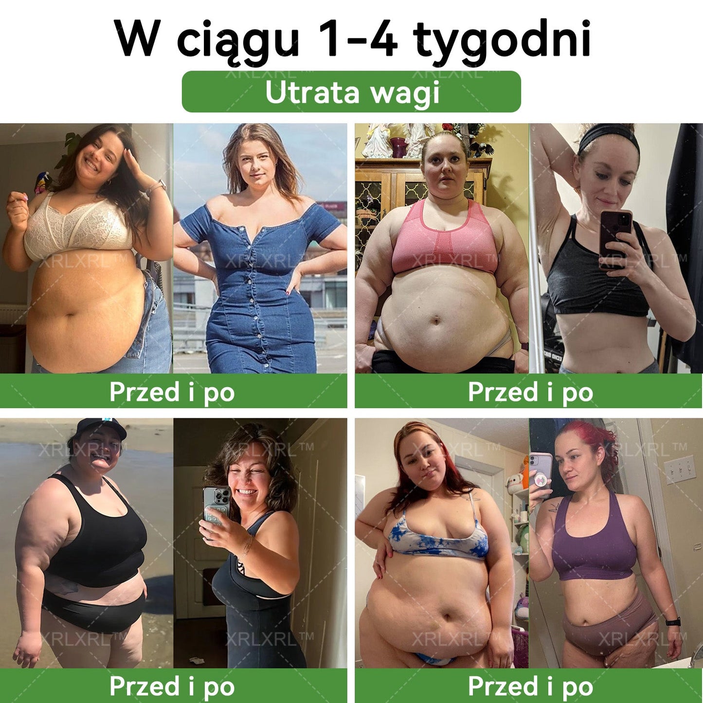 波兰XRLXRL™ Potężna HerbIon Negatywna Jonowa Detox Plaster Odchudzający - Rekomendowane przez ASMBS