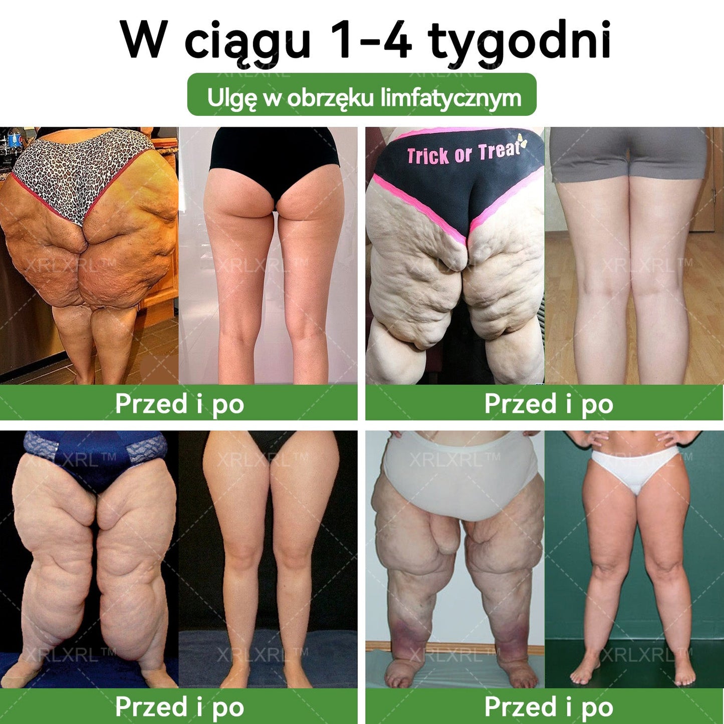 波兰XRLXRL™ Potężna HerbIon Negatywna Jonowa Detox Plaster Odchudzający - Rekomendowane przez ASMBS