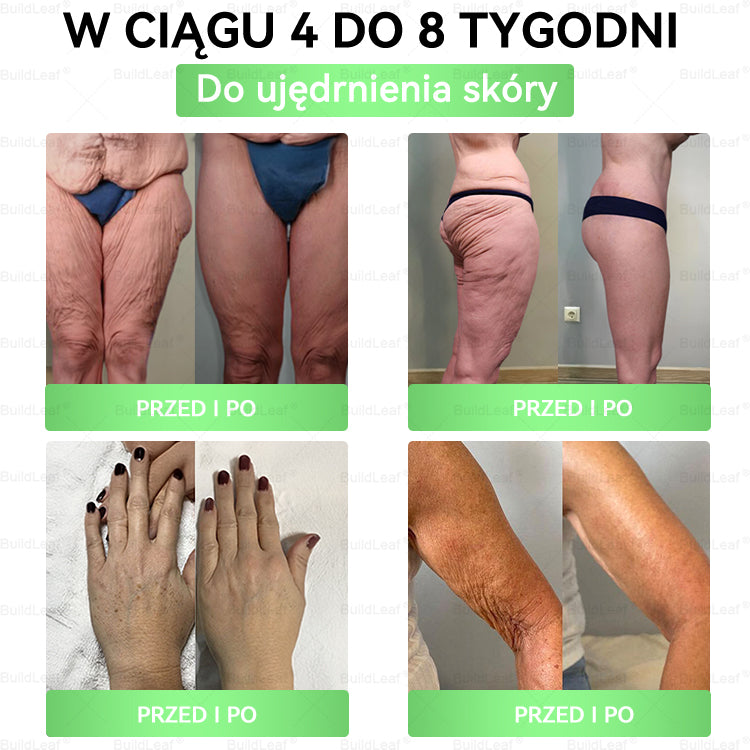 BuildLeaf® GLP-1 20 w 1 Slim & Health Oral Solution , zawierający 100 miliardów CFU aktywnych probiotyków ✅ Wspomaga kontrolę wagi, zdrowie serca, cukrzycę, a jednocześnie ujędrnia skórę i dodaje energii.