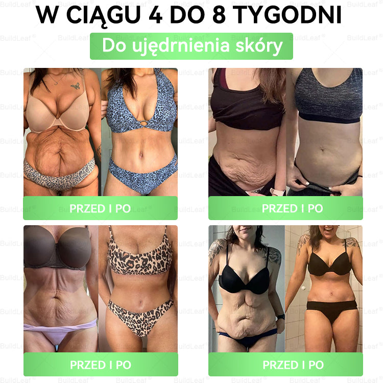 BuildLeaf® GLP-1 20 w 1 Slim & Health Oral Solution , zawierający 100 miliardów CFU aktywnych probiotyków ✅ Wspomaga kontrolę wagi, zdrowie serca, cukrzycę, a jednocześnie ujędrnia skórę i dodaje energii.